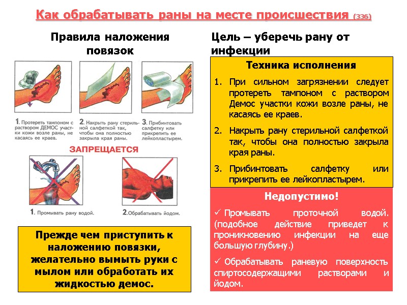 Как обрабатывать раны на месте происшествия (336) Правила наложения повязок  Цель – уберечь
